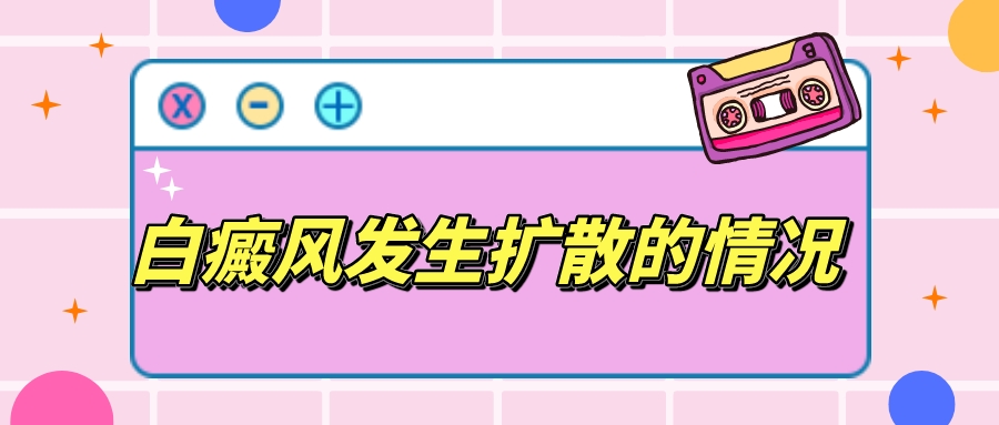 白癜风什么情况下发生扩散